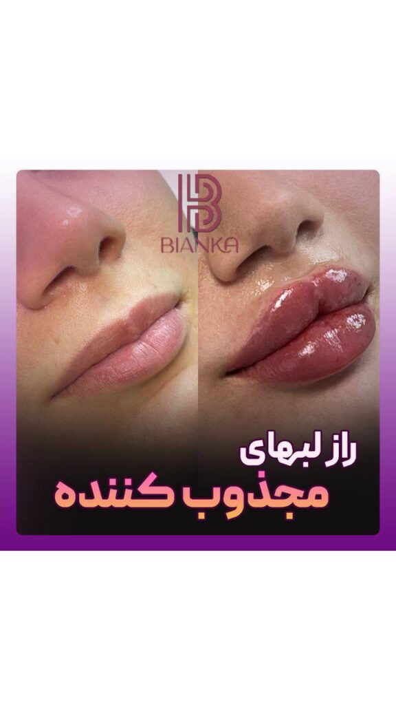 کلینیک زیبایی بیانکا ژل